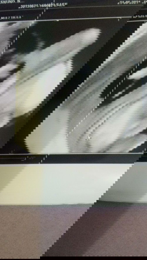 USG 4d 3x jk cewe terus udh fix belum ya