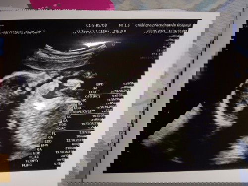 ช่วยแม่ตั้งชื่อเล่นลูกหน่อยค่ะ