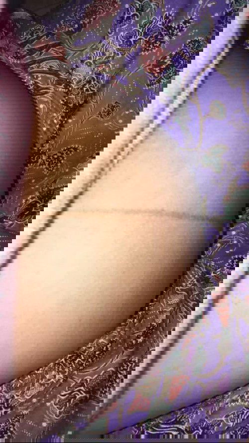 ท้องแล้วผิวเข้มขึ้นตามท้องตามขาตามคอ. แม่ๆบ้านไหนเป็นแบบนี้บ้างค่ะ