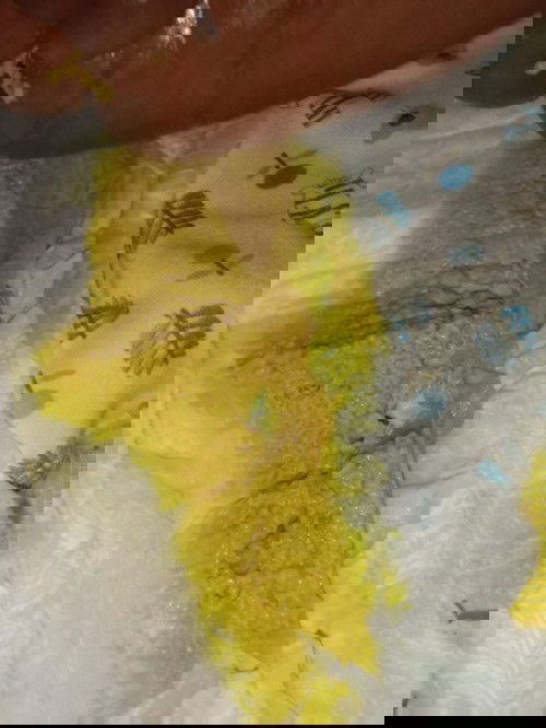 Bayi jadi sering BAB