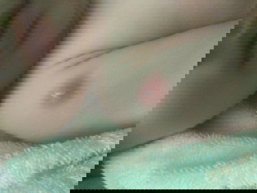 Bekas suntik BCG bengkak kemerahan