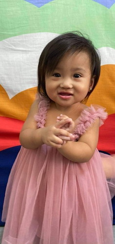 BUKOL SA KALIWANG BRASO NI BABY