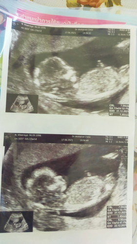 14week กลับมาแพ้เหมือนเดิมค่ะ😌