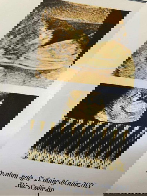 Em bầu 11w5d em siêu âm bs bảo là con gái vậy có chính xác chưa ạ 😌😌😌