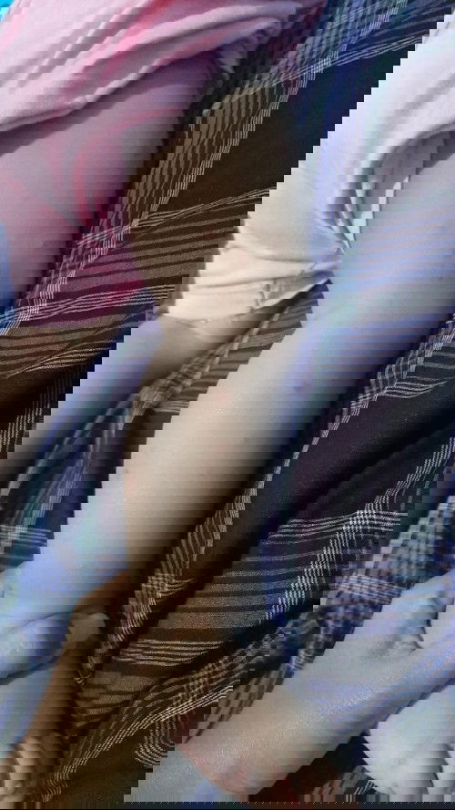 Mengatasi cacar air bayi 8,5 bulan.