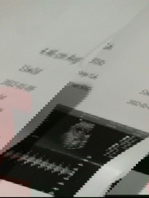 Numpang curhat ya bunda