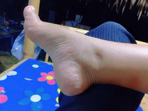 37+4 ท้องไม่เเตกจ้า เริ่มบวมกดบุบ😄