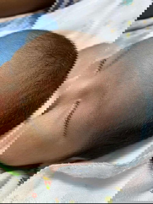 แบบนี้เป็นผื่นชนิดไหนคะ