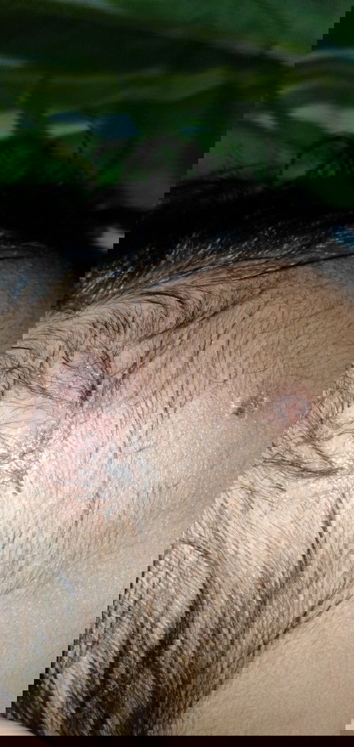 Bengkak dan berair di kepala