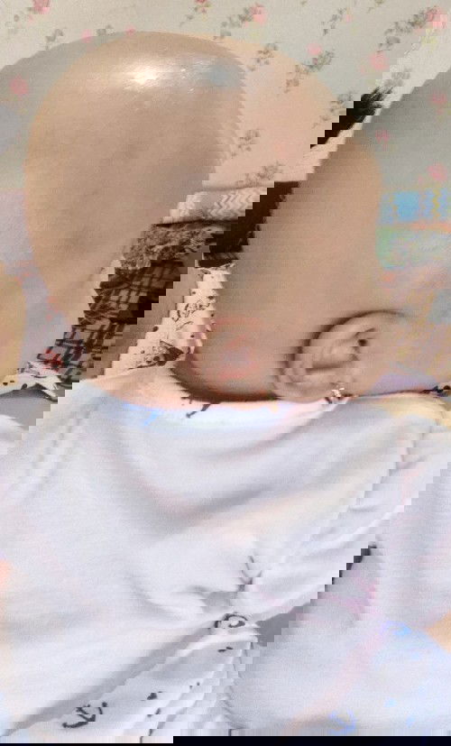 Apakah bayi harus dibotak ?