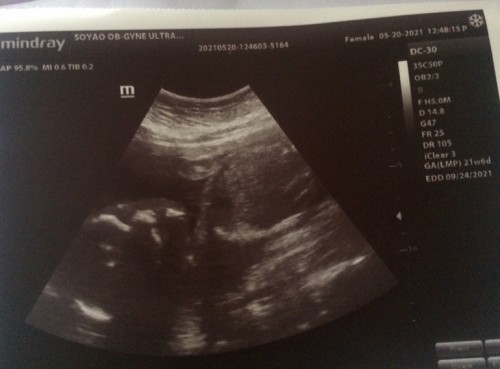 Mga mommy pasagot naman po nag aalala po kase ako