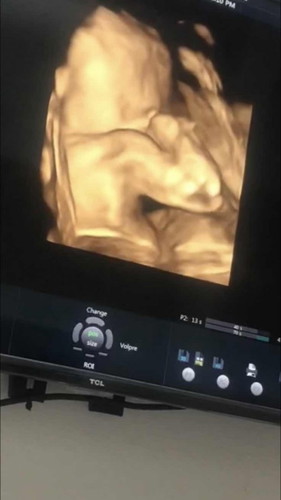 แม่ๆมีวิธีการแก้อาการคันหน้าท้องยังไงบ้างคะ…..23w คันมากก