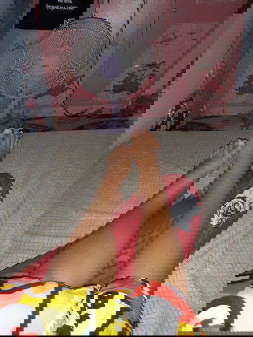 34+5w มีแม่ๆท่านไหนบวมแบบนี้บ้างคะ