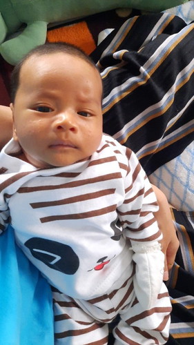 Bintik² di pipi bayi