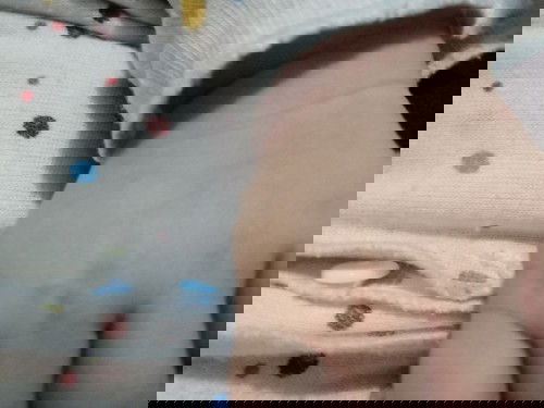 Penyakit gatal pada bayi