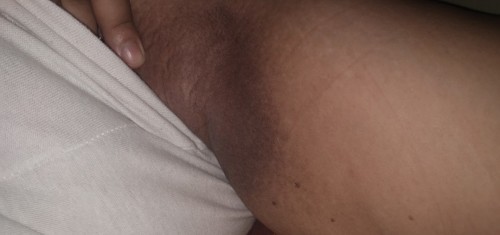 Dark underarm