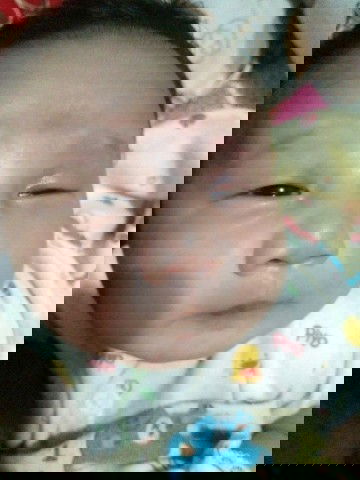 Mata susah ke buka sebelah kiri