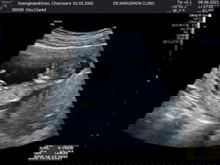 นอนสบายเลยนร้าาลูก