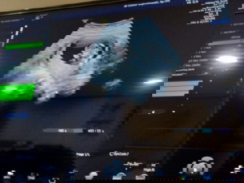 Sempat Cemas dan ternyata...