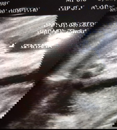 Gender? Girl or Boy?