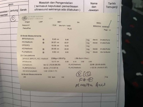 Hi mommy , nk tanya . Ada yang sudi kongsi ilmu tk ? berat baby 2398g+/-359.67g . APA MAKSUD ( -358.67g ) tu ?