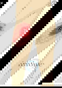 Masakit na singit after manganak (groin pain)