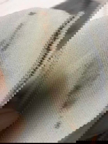 มันคืออะไรคะช่วยบอกที่ รู้สึกว่าเป็นเมื่อคืนเหมือนเลือดเลยคะ แม่ควรไปหาหมอมั้ยท้องได้6สัปดาห์