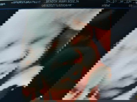 CS experience