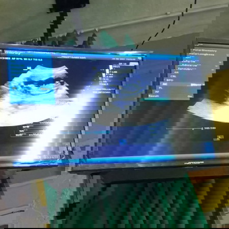 Sempet worry bngt setelah seharian kmren flek, dan alhamdulillah di usg masih baik² aja..