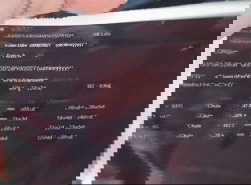 ขอถามเเม่ๆหน่อยนะคะ