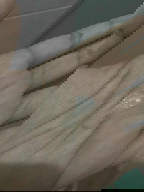 มูกใสหรือตกขาวคะ