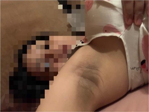 มาแชร์ประสบการณ์ความดำตอนท้องกันค่ะ