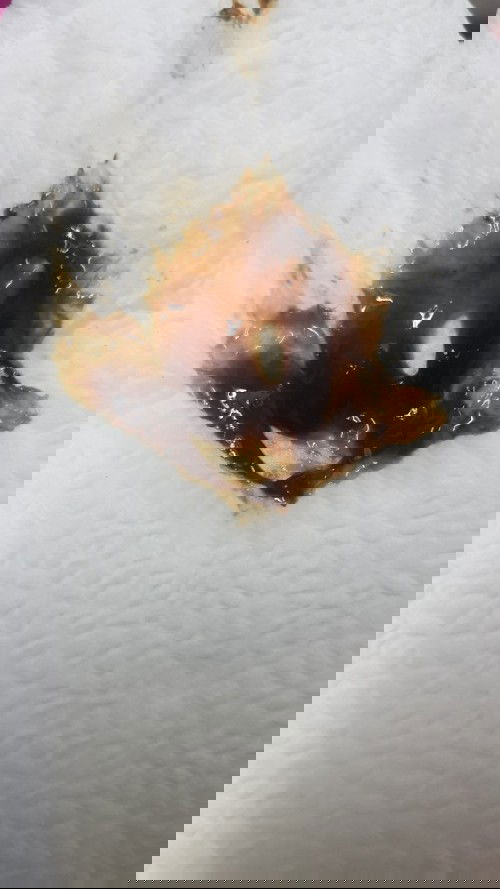 แบบนี้ปกติมั้ยคะ