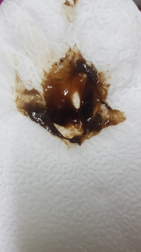 แบบนี้ปกติมั้ยคะ