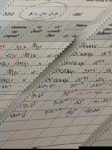 เครียด น้ำหนักลด