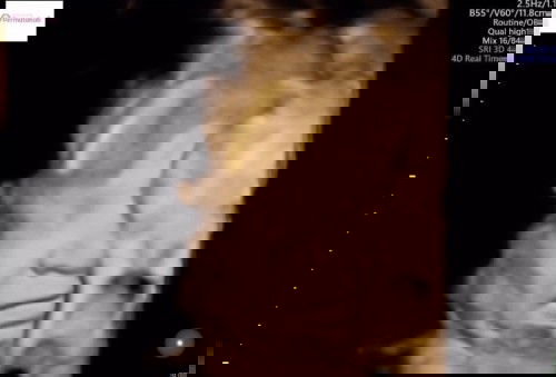 10 Hari menjelang HPL