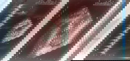 อยากรู้น้ำหนักของน้องแม่
ที่อายุครรภ์ 20+1w จ้า🥰 
น้องมีน้ำหนักเท่าไรกันแล้วมั้งจ้า