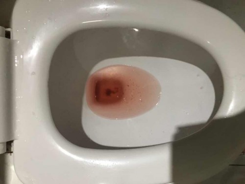 Implantation bleeding or menstruation?