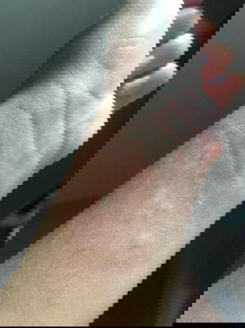 เป็นไรมั้ยคะ