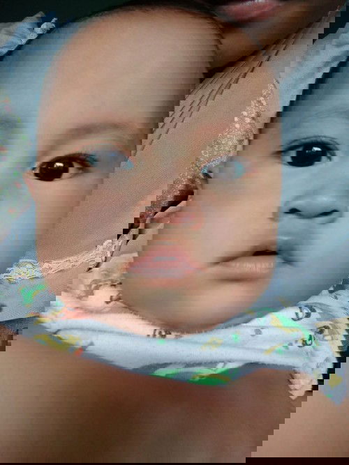 Wajah merah² seperti biduran