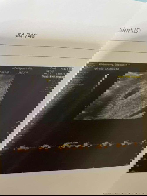 แบบนี้เรียกเจอน้องไหมค่ะ