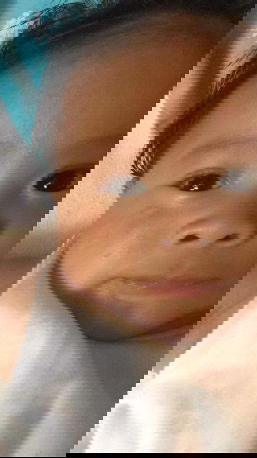 bungang araw or rashes?