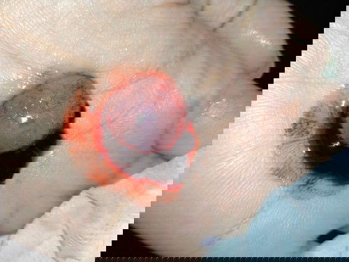 เด็กน้อยของแม่ ขอโทษที่รักษาหนูไว้ไม่ได้😭😭