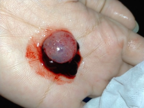 เด็กน้อยของแม่ ขอโทษที่รักษาหนูไว้ไม่ได้😭😭