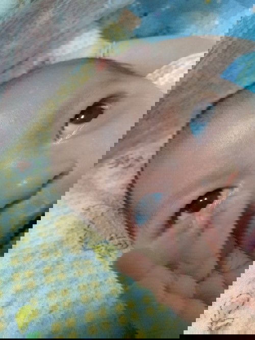 Bercak putih di jidat umur satu bulan 1 2 minggu