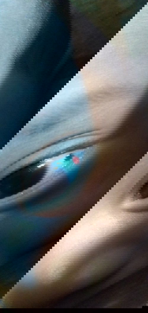 Bercak darah di mata bayi 1 bulan