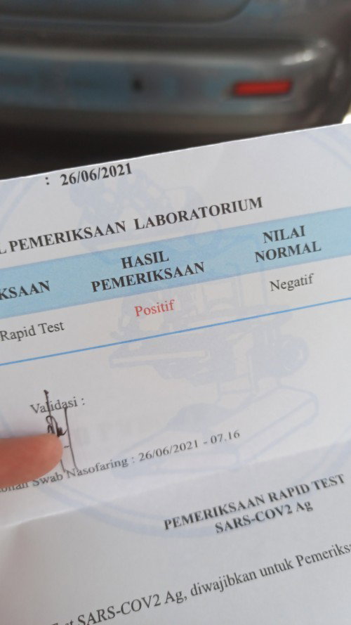 Positif covid saat hamil