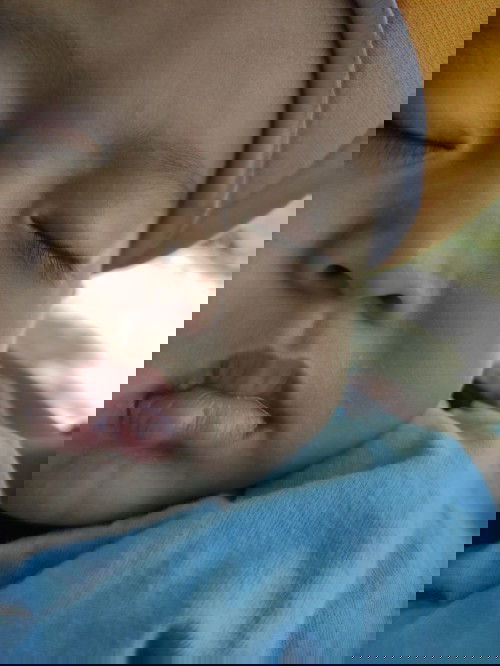 Cara menghilangkan bercak putih