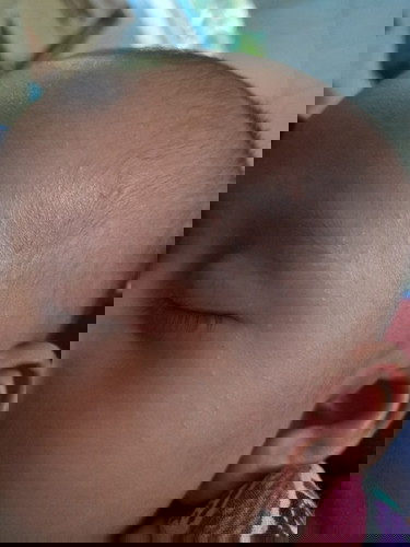 Bunda" mau tanya gimana ya cara ngilangin bintik" di wajah dede??