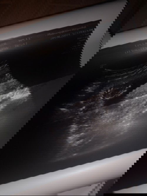 อยากทราบจริงๆค้ะท้องแรกดูไม่เป็น